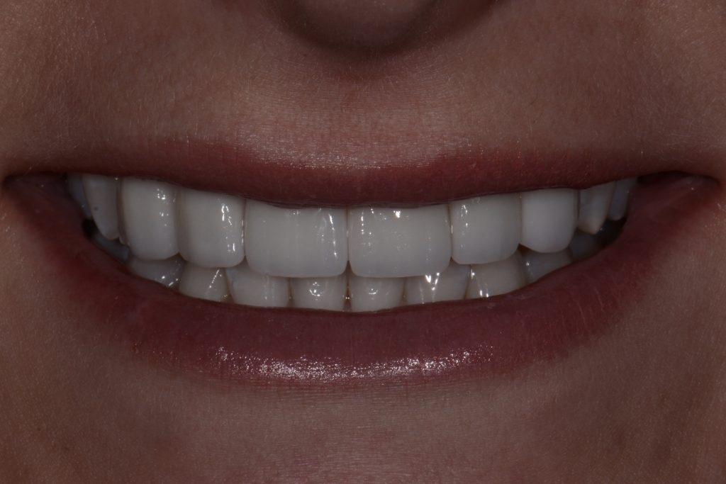 Parkside Dental smile transformation