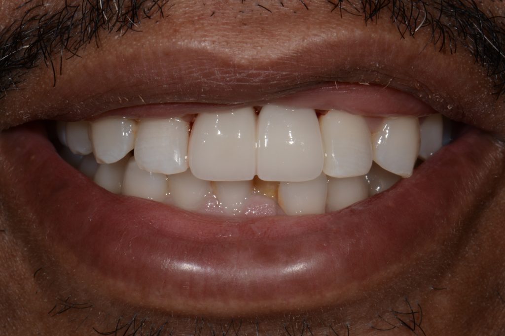 Parkside Dental smile transformation