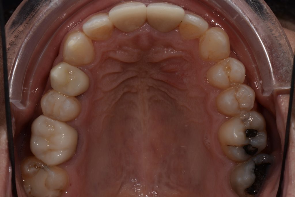 Parkside Dental smile transformation