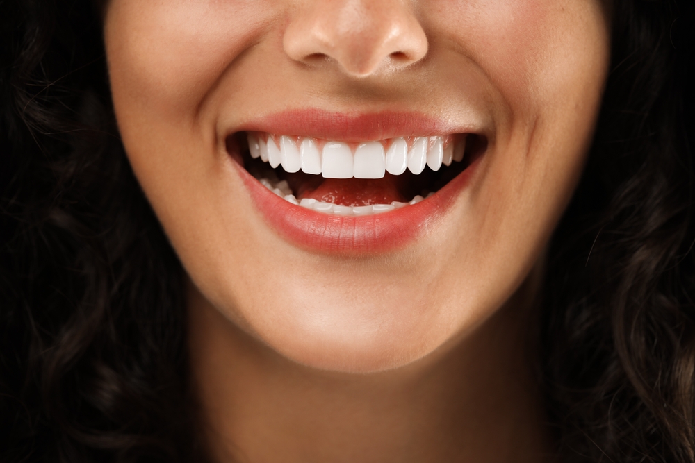 white smile at Parkside Dental